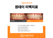 원데이 치아미백 치료사례
